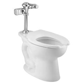 Ultima Touchless Sensor Toilet Flush Valve, Diaphragm-Type, 1.28 Gpf/4.8 Lpf, 6147Sm121.002