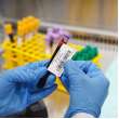 Chemical Resistant Cryogenic Polypropylene Labels for 1